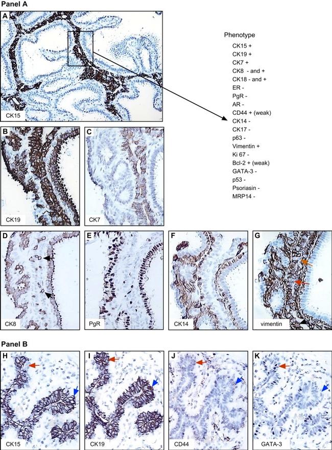 Cytokeratin 15 Antibody in Immunohistochemistry (IHC)