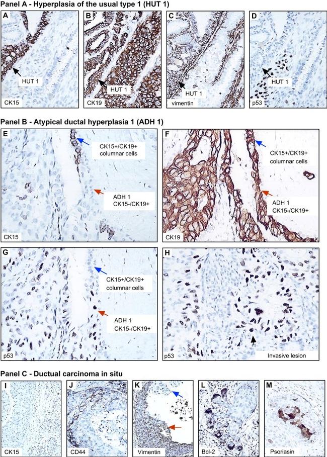 Cytokeratin 15 Antibody in Immunohistochemistry (IHC)