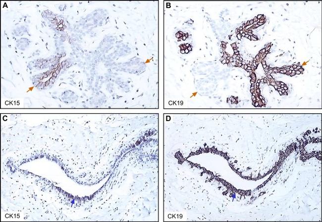 Cytokeratin 19 Antibody in Immunohistochemistry (IHC)