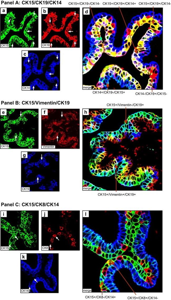 Cytokeratin 19 Antibody in Immunohistochemistry (IHC)