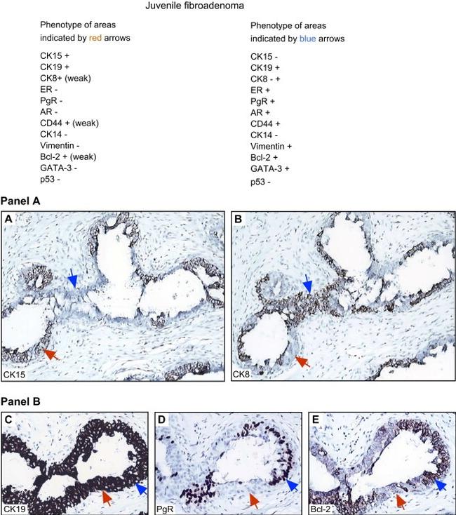 Cytokeratin 19 Antibody in Immunohistochemistry (Paraffin) (IHC (P))