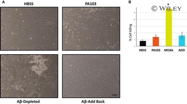 beta Amyloid Antibody in Neutralization (Neu)