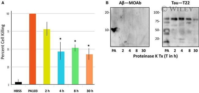 beta Amyloid Antibody in Western Blot (WB)