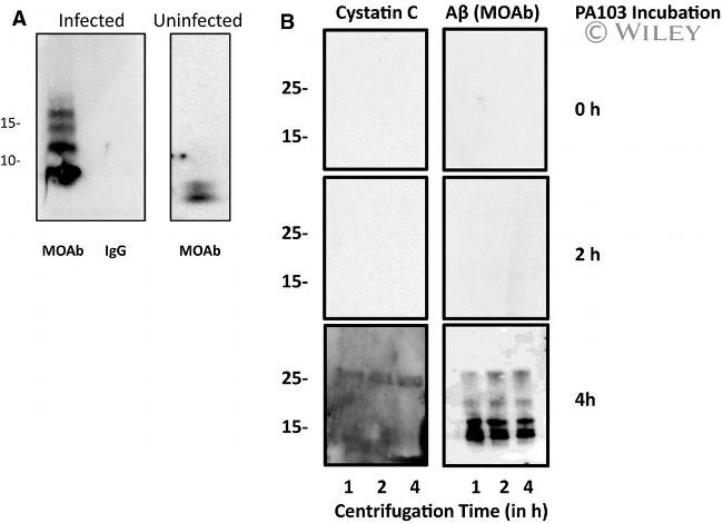 beta Amyloid Antibody in Western Blot (WB)