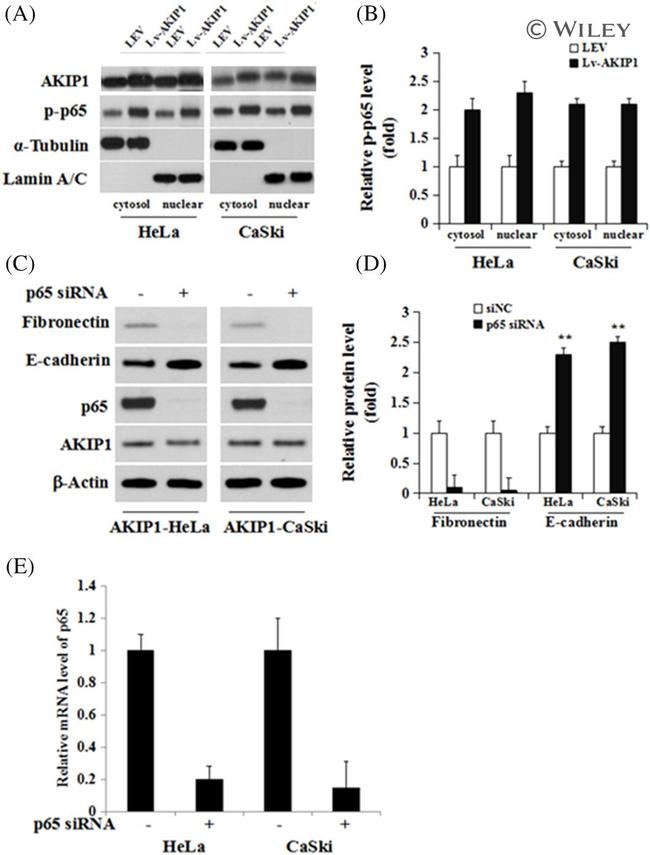 NFkB p65 Antibody in Western Blot (WB)