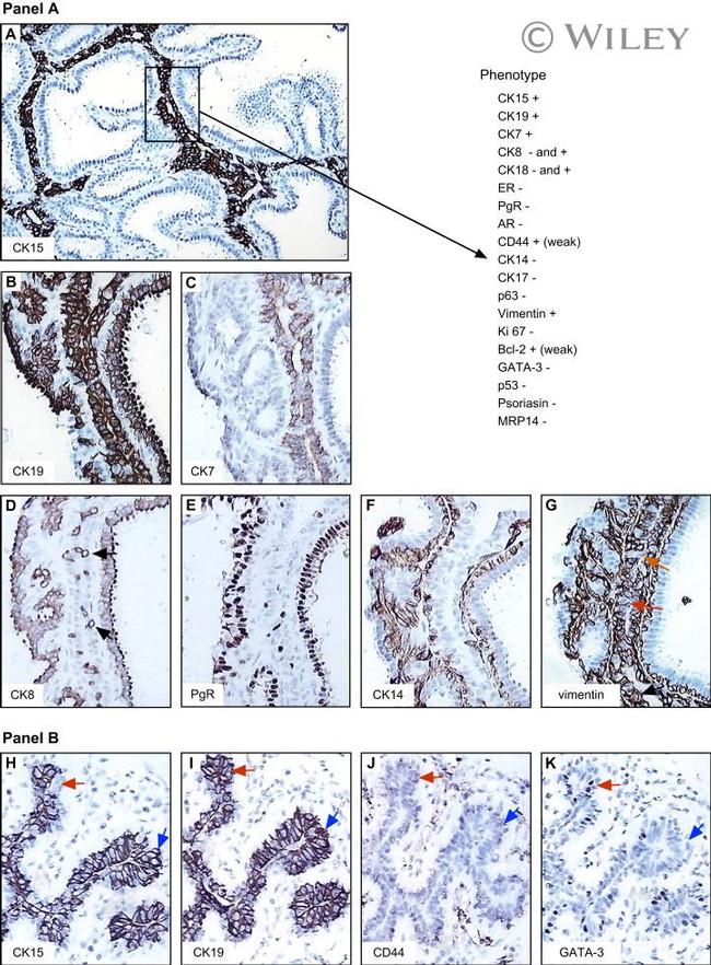 Cytokeratin 19 Antibody in Immunohistochemistry (IHC)