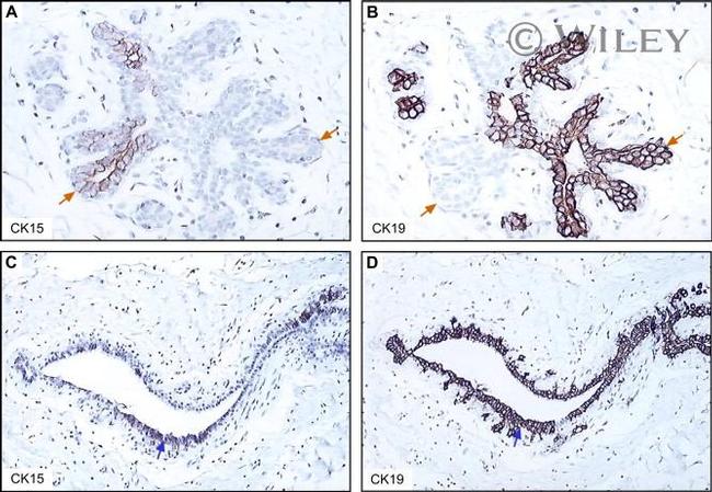 Cytokeratin 19 Antibody in Immunohistochemistry (IHC)