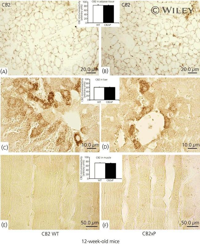 CNR2 Antibody in Immunohistochemistry (IHC)