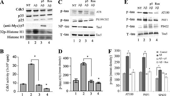 Phospho-Tau (Ser202, Thr205) Antibody in Western Blot (WB)