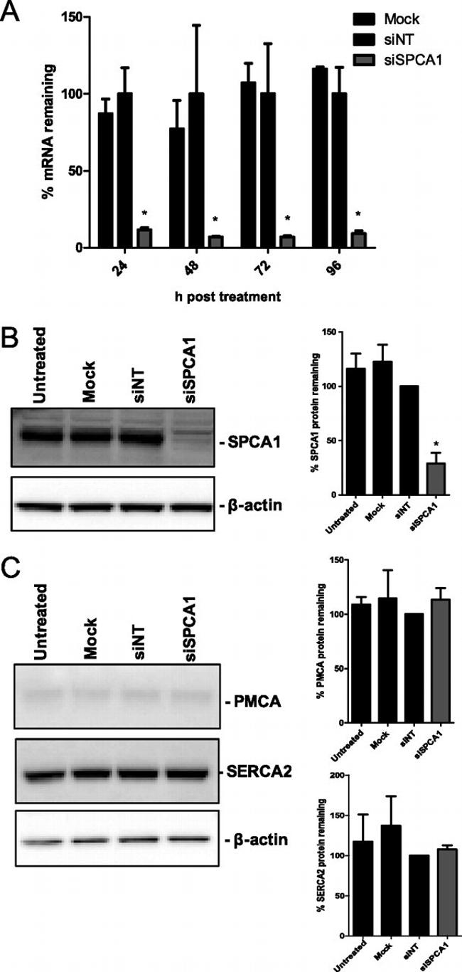 SERCA2 ATPase Antibody in Western Blot (WB)