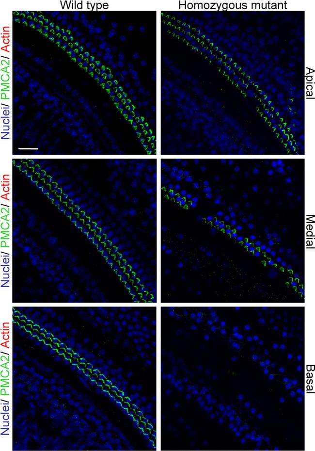 PMCA2 ATPase Antibody in Immunohistochemistry (IHC)