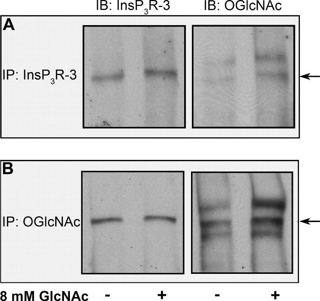 O-linked N-acetylglucosamine (O-GlcNAc) Antibody in Western Blot, Immunoprecipitation (WB, IP)