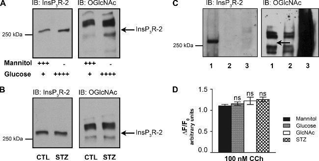 O-linked N-acetylglucosamine (O-GlcNAc) Antibody in Western Blot (WB)