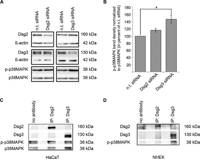 Desmoglein 3 Antibody in Immunoprecipitation (IP)