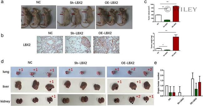 LBX2 Antibody in Immunohistochemistry (IHC)