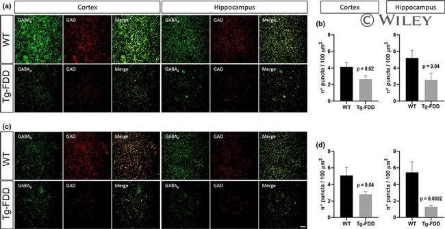 GABBR1 Antibody in Immunohistochemistry (IHC)