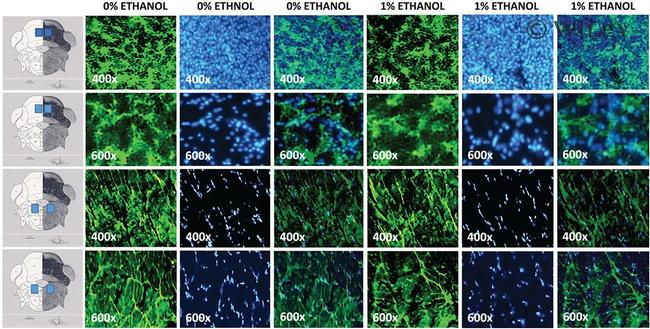 GFAP Antibody in Immunohistochemistry (IHC)