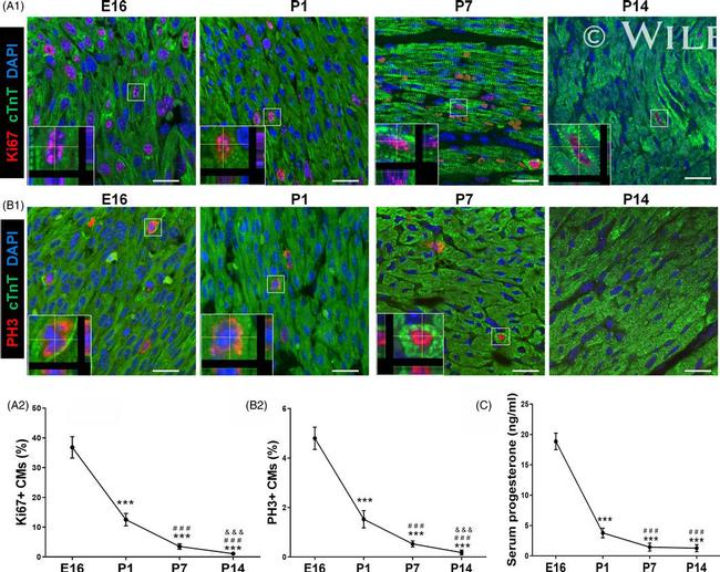 Cardiac Troponin T Antibody in Immunohistochemistry (IHC)