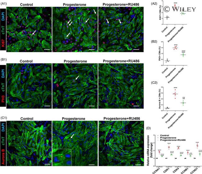 Cardiac Troponin T Antibody in Immunohistochemistry (IHC)