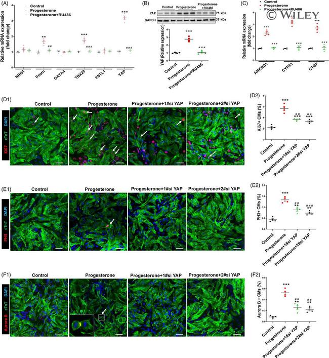 Cardiac Troponin T Antibody in Immunohistochemistry (IHC)