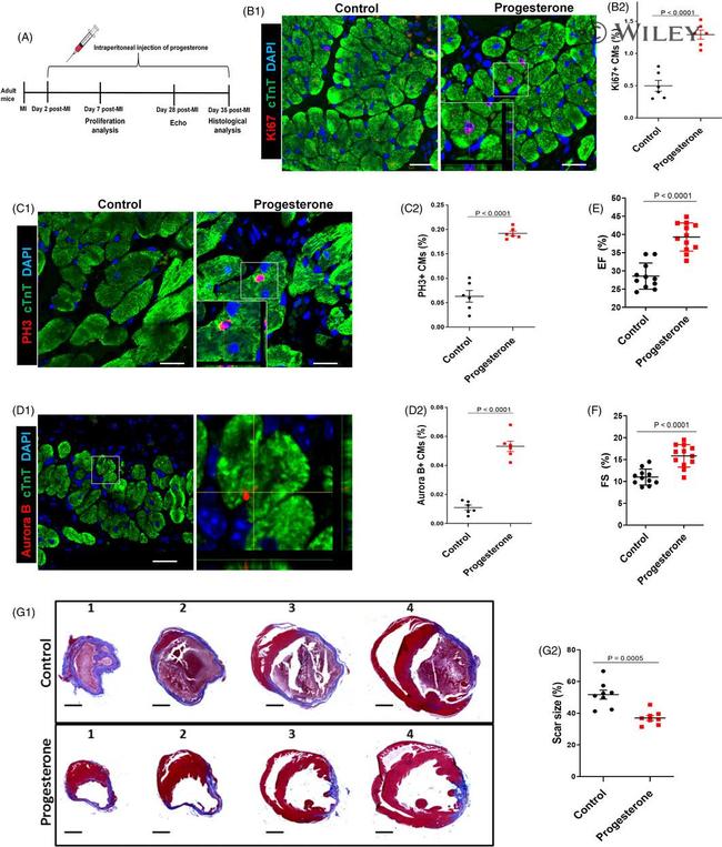 Cardiac Troponin T Antibody in Immunohistochemistry (IHC)