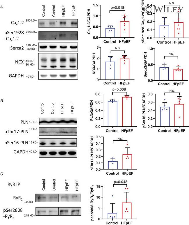 SERCA2 ATPase Antibody in Western Blot (WB)