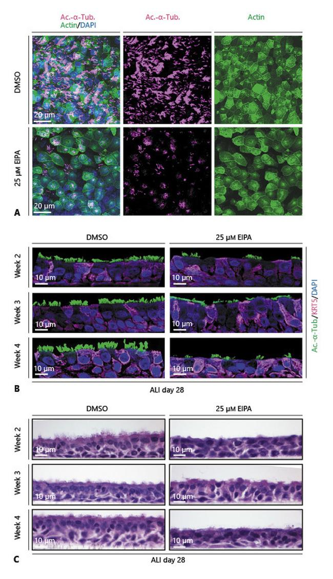 Cytokeratin 5 Antibody in Immunohistochemistry (IHC)