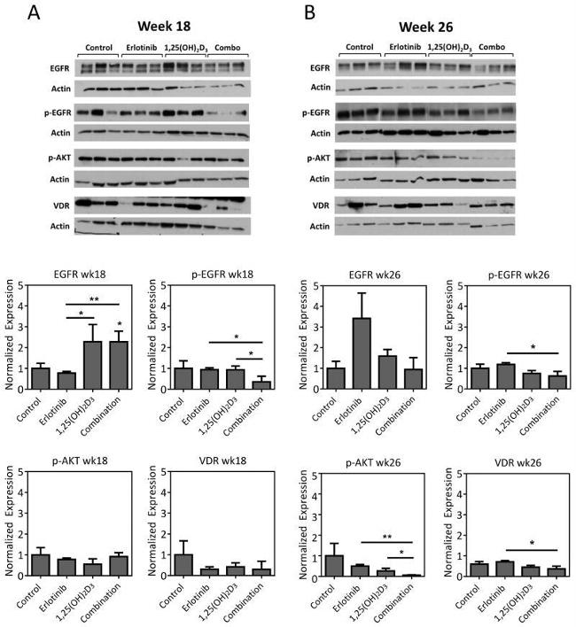 VDR Antibody in Western Blot (WB)