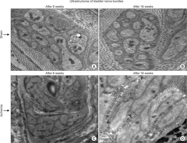 S100A1 Antibody in Immunohistochemistry (Paraffin) (IHC (P))