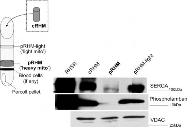 SERCA2 ATPase Antibody in Western Blot (WB)