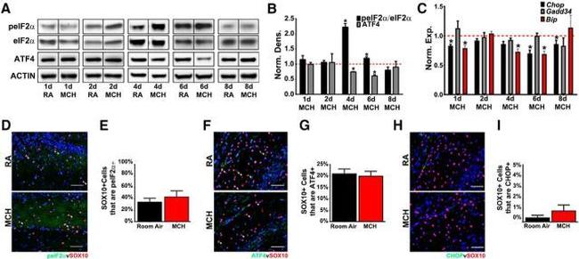 CHOP Antibody in Immunohistochemistry (IHC)