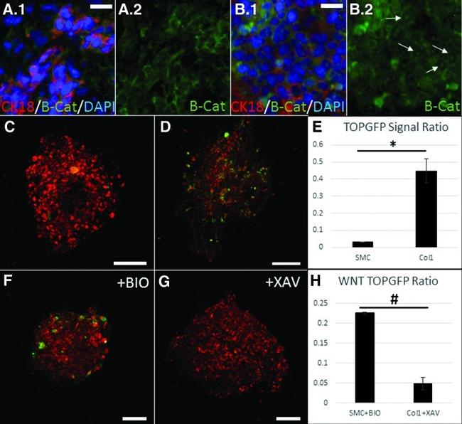 beta Catenin Antibody in Immunohistochemistry (IHC)