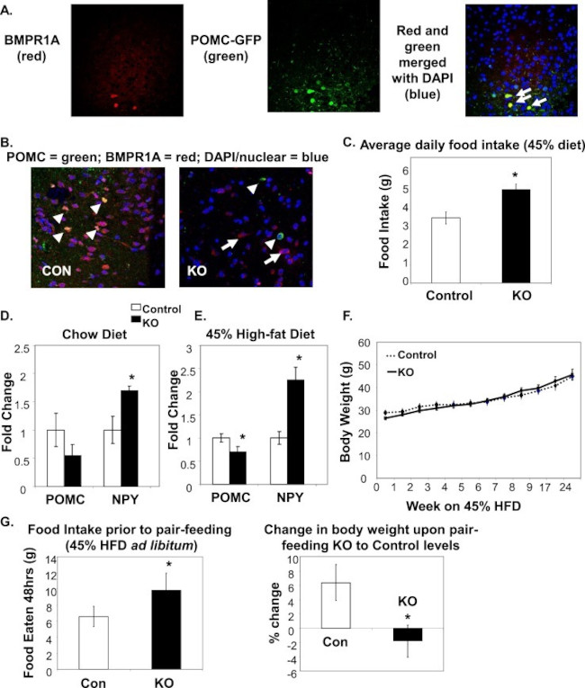 BMPR1A Antibody in Immunohistochemistry (IHC)