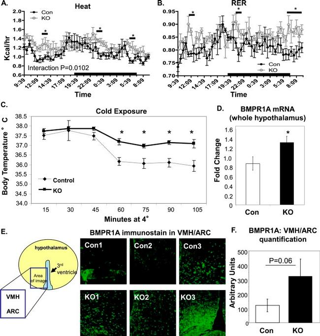 BMPR1A Antibody in Immunohistochemistry (IHC)