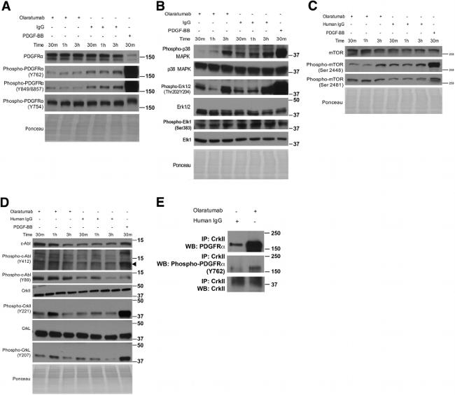 Phospho-PDGFRA/PDGFRB (Tyr572, Tyr574) Antibody in Western Blot (WB)