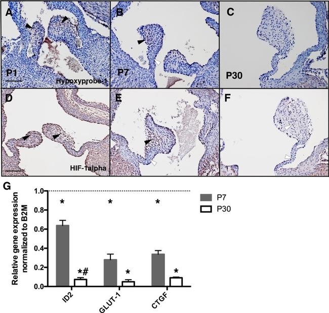 HIF1A Antibody in Immunohistochemistry (IHC)