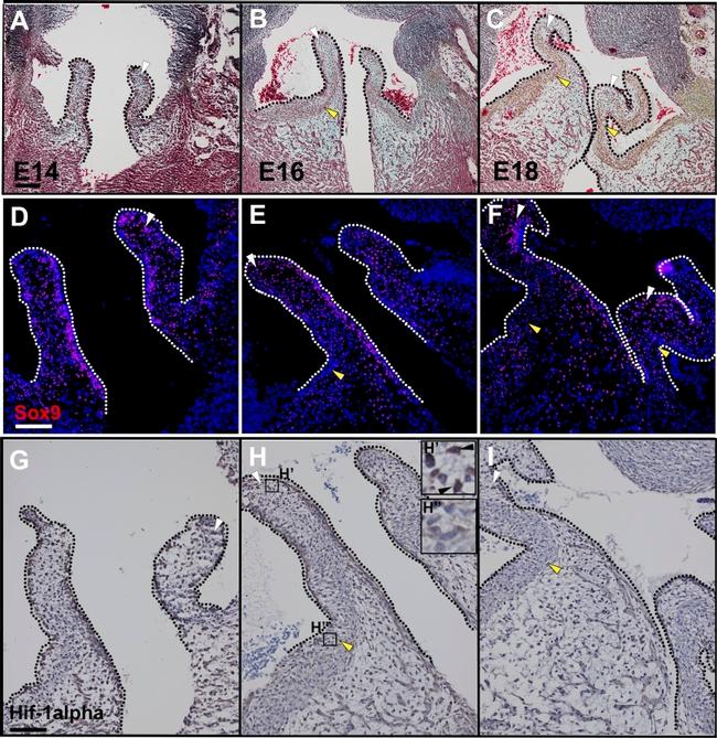 HIF1A Antibody in Immunohistochemistry (IHC)