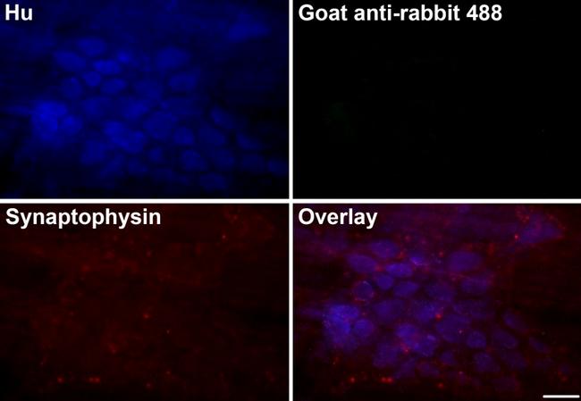 HuC/HuD Antibody in Immunohistochemistry (IHC)