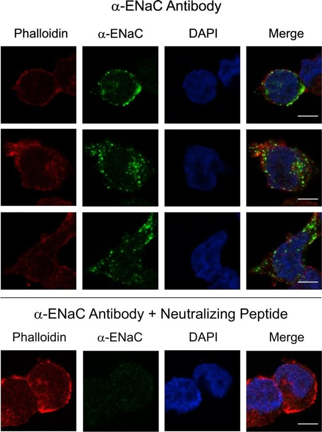 alpha-ENaC Antibody in Immunocytochemistry (ICC/IF)