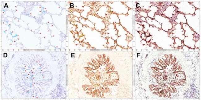 Cytokeratin Pan Antibody in Immunohistochemistry (IHC)