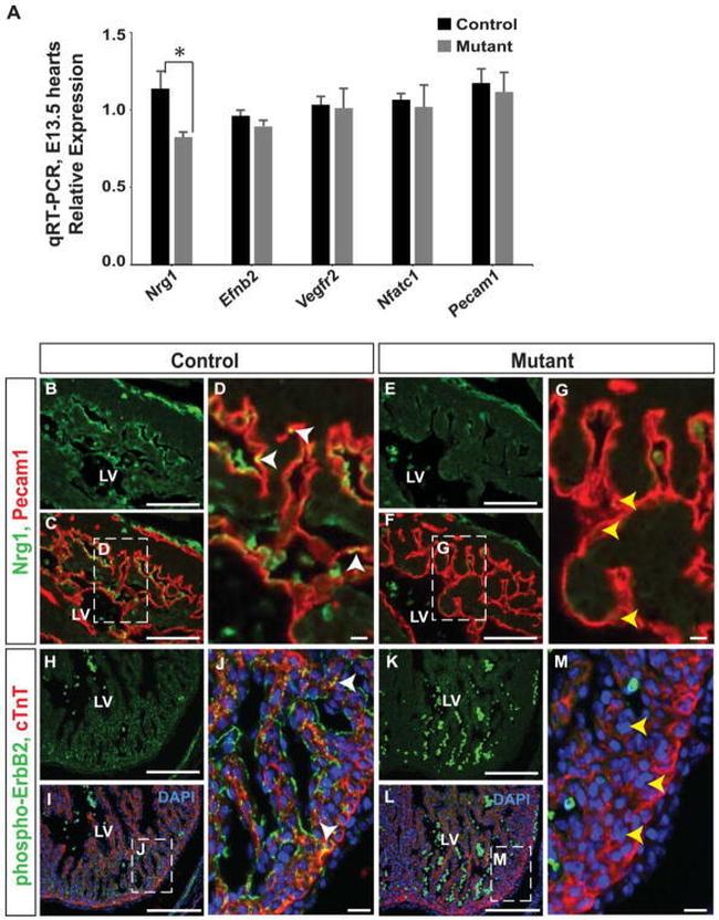 Cardiac Troponin T Antibody in Immunohistochemistry (IHC)