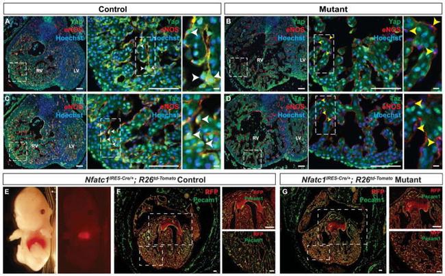 Cardiac Troponin T Antibody in Immunohistochemistry (IHC)