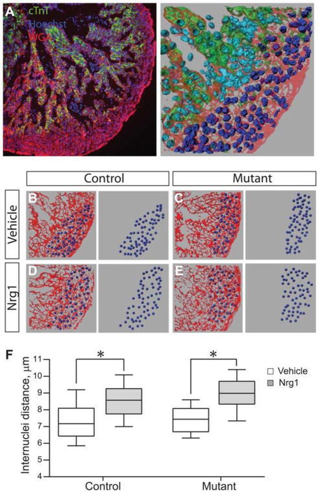 Cardiac Troponin T Antibody in Immunohistochemistry (IHC)