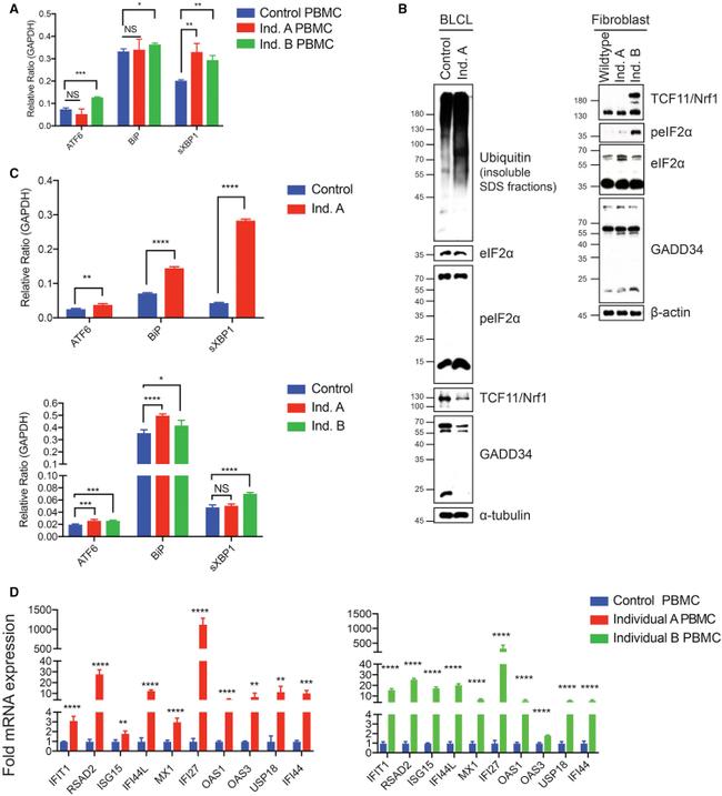 GADD34 Antibody in Western Blot (WB)