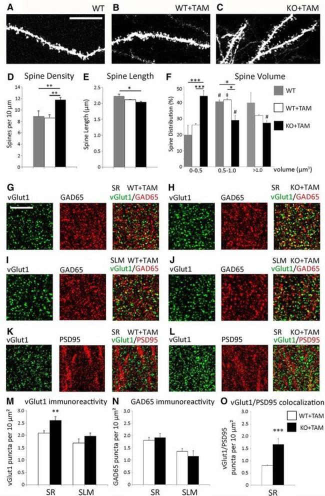 VGLUT1 Antibody in Immunohistochemistry (IHC)