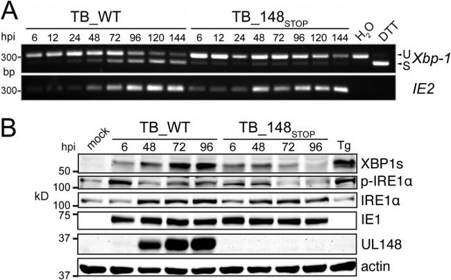 Phospho-IRE1 alpha (Ser724) Antibody in Western Blot (WB)