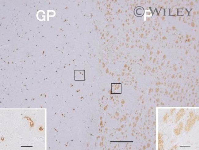 beta Amyloid (1-42) Antibody in Immunohistochemistry (IHC)