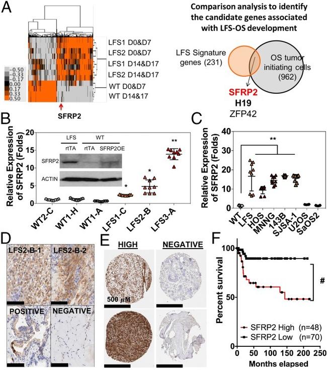 SFRP2 Antibody in Immunohistochemistry (IHC)