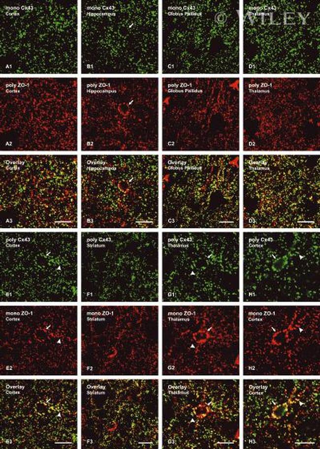 Connexin 43 Antibody in Immunohistochemistry (IHC)