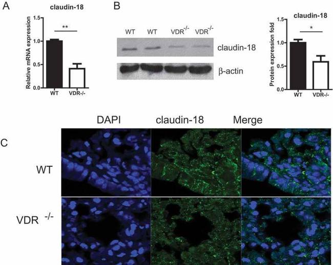 Claudin 18 Antibody in Western Blot (WB)